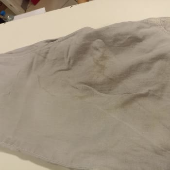 Mavi Pantolonun Rengi Değişti