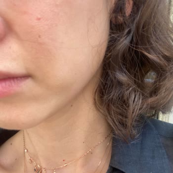 Fatma Süha Beauty Frozen Face Ve Eyes Hiçbir Etki Olmadı