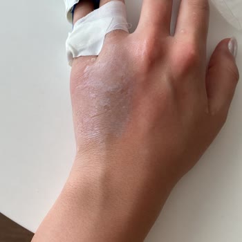 Sueno Otel Bize Ücret İadesi Yapmadı