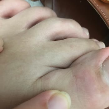 Zara Terlik Kalitesizliği Ve Ayağı Yara Etmedi