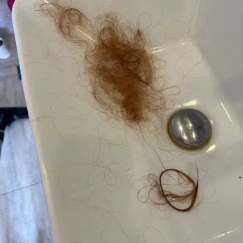 Yılmaz Peruk Sentetik Saç Satıyorlar Gerçek Saç Diye