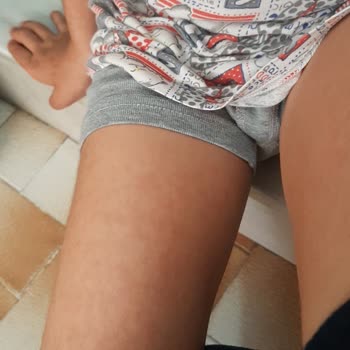 Peros Marka Alerji Yaptı