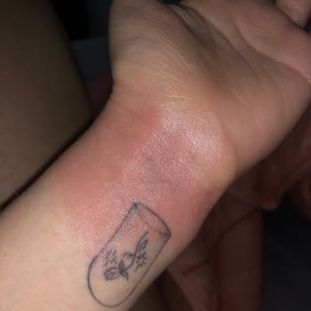 Tereson Sprey Cildimi Tahriş Etti