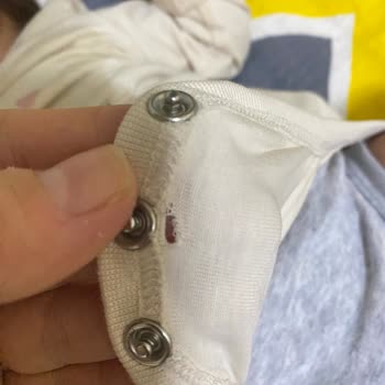 H&M Bebek Kıyafeti Yırtıldı