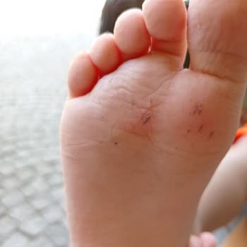 Costa Farilya Special Class Hotel Materyal Bakımlarının Yapılmaması