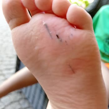 Costa Farilya Special Class Hotel Materyal Bakımlarının Yapılmaması