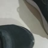 Adidas Ayakkabının Yırtılması FLO Ayakkabı Duyarsızlığı