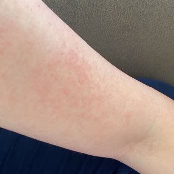 Isana Rossmann %10 Urea Krem