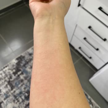 Isana Rossmann %10 Urea Krem