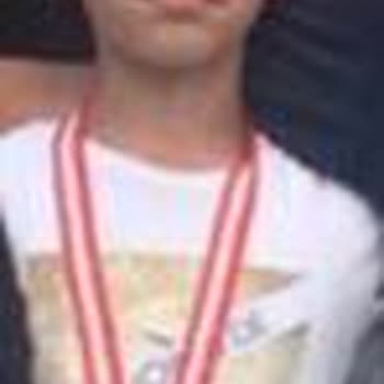 Samsung Telefon Kamera Net Çekmemesi Ve Servisin Ücret Çıkarması