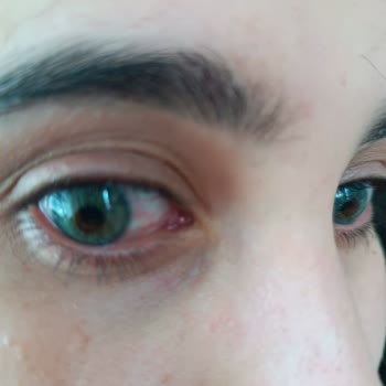 Karabük Aden Vip Güzellik Merkezi'nde Epilasyon Paketi Aldım