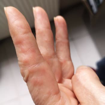 Abdi İbrahim Factive Antibiyotik Zararları