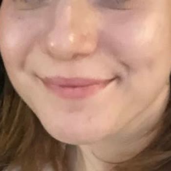 Selin Beauty Dragos Şube Cilt Bakımı (Pumpkin Peel) Mağduriyeti