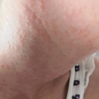 Baby Sebamed Çok Yönlü Koruyucu Güneş Spreyi