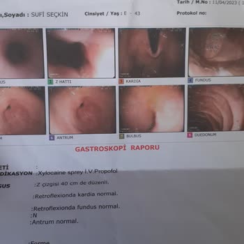 Dr. Ferhat Çelik'e Mide Botoksu Yaptırdım, İşlem Başarısız Oldu