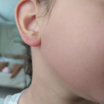 Bioderma Photoderm Kid 50 Alerjik Reaksiyon