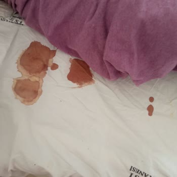 Celal Bayar Üniversitesi Hafsa Sultan Hastanesi İlgi Yok