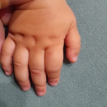 Novada Edremit AVM İçerisinde Kızımın Elini Köpek Isırdı