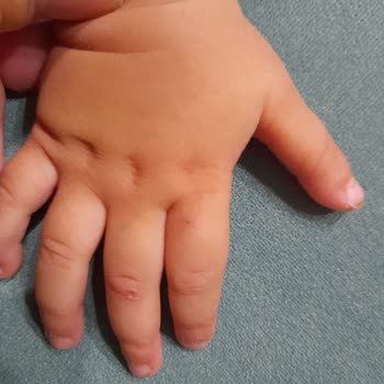 Novada Edremit AVM İçerisinde Kızımın Elini Köpek Isırdı