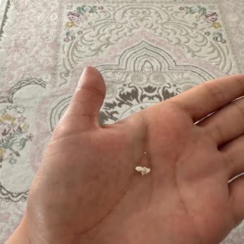 Beyaz Işık Ağız ve Diş Sağlığı Beyaz Işık Van