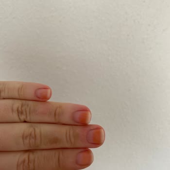 Pastel Kozmetik Oje Tırnağımda Turuncu Leke Bıraktı