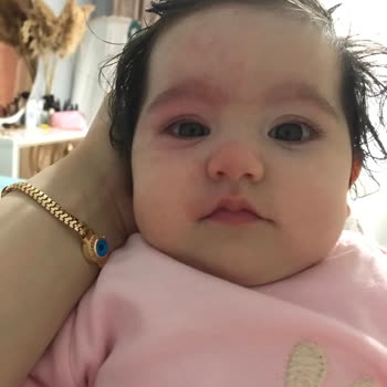 Uni Baby Kızarıklık Ve Şişkinlik