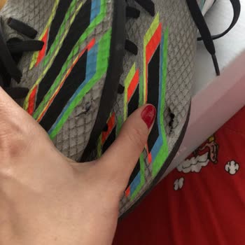 Adidas Krampon 4 Ayda Patladı