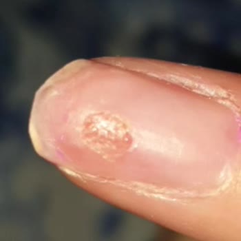 Duygu Doğan Kuaför Tırnak Bakımı Sonrası Kötü Deneyim