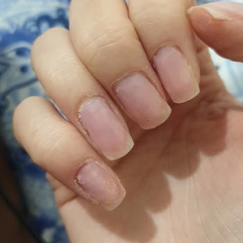 Duygu Doğan Kuaför Tırnak Bakımı Sonrası Kötü Deneyim