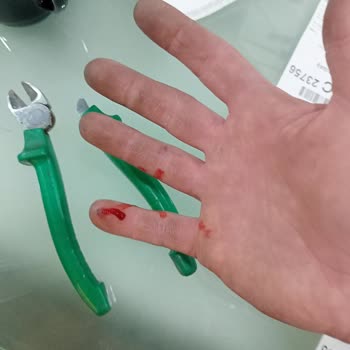 İzeltaş Yan Keski Kırılıp Hem Maddi Hem Bedensel Sağlık Zararı Verdi