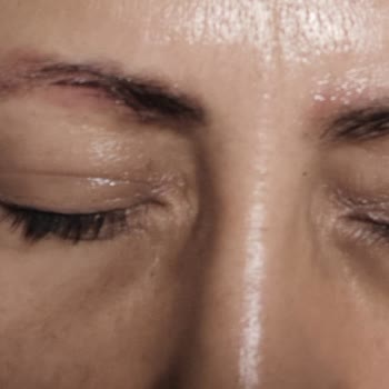 Beyhan Ateşoğlu Beauty Center Kaş Silmeden Dolayı Cildimde Yanık Oluştu