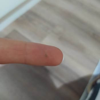 Voonka Çinko Tabletin İçinden Yabancı Cisim Çıktı