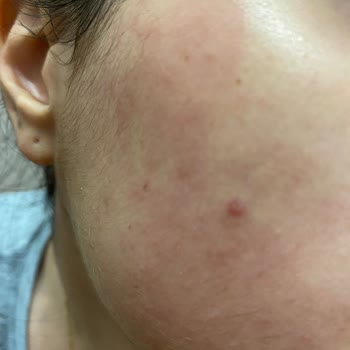 Watsons Tüy Sarartıcı Krem Tahriş Etti