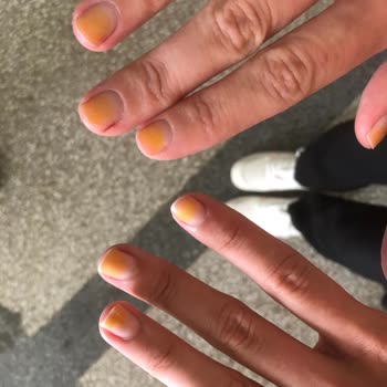 Pastel Kozmetik Pastel 271 Numaralı Oje Tırnakta Turuncu Leke Bırakıyor