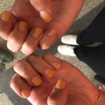 Pastel Kozmetik Pastel 271 Numaralı Oje Tırnakta Turuncu Leke Bırakıyor
