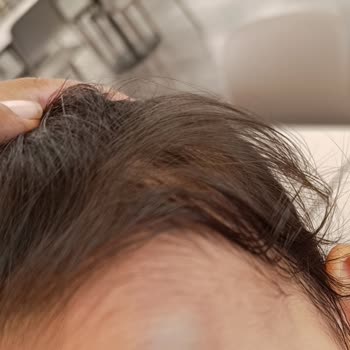 StarCity Outlet Center StarCity AVM De Metal Taşıyıcı Direkler