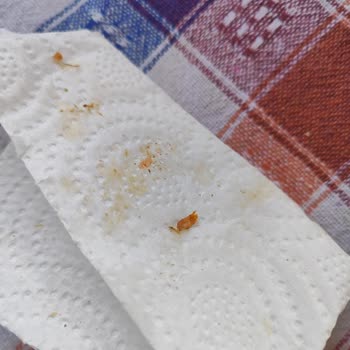 Mansur Gross'tan Alınan Et Ürününün Kıllı Olması