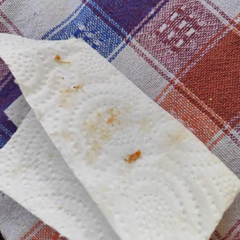 Mansur Gross'tan Alınan Et Ürününün Kıllı Olması