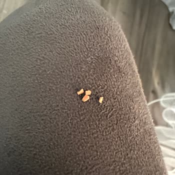 Magnumdan Çıkan Parça Dişimi Kırıyordu