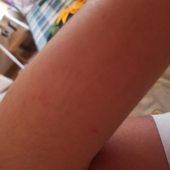 Seferihisar Ürkmez'de Çok Sivri Sinek Var