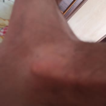 Seferihisar Ürkmez'de Çok Sivri Sinek Var