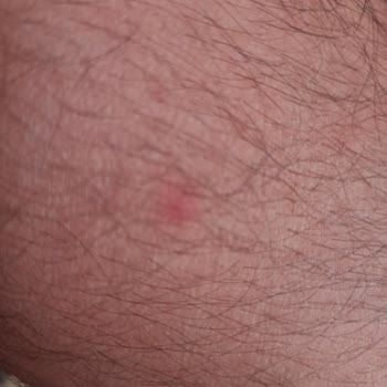 Seferihisar Ürkmez'de Çok Sivri Sinek Var