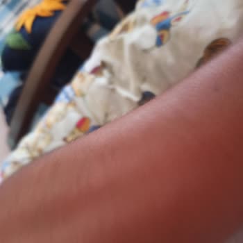 Seferihisar Ürkmez'de Çok Sivri Sinek Var