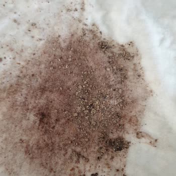 Özem'le Yaşam Kisthene Elma Sirkesi Bozuk Çıktı