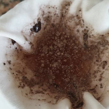 Özem'le Yaşam Kisthene Elma Sirkesi Bozuk Çıktı