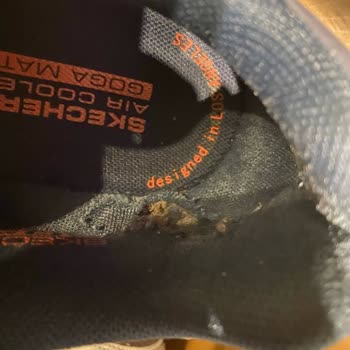 Skechers Ayakkabımın İç Tarafı Yırtıldı Ve Marka Kullanıcı Hatası Dedi