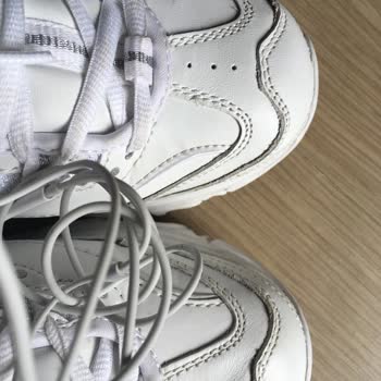 Skechers Ayakkabının Burnunda Ki Deri Kalitesizliği