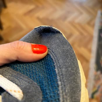 New Balance 1,5 Senede Yırtılan Ayakkabı