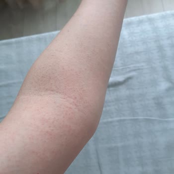 Rossmann Isana %10 Üre İçerikli Vücut Sütü