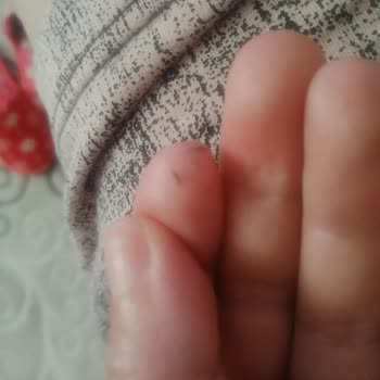 Loreal Paris Krem Yüzümde Kir Gibi Bir Şeyler Bırakıyor